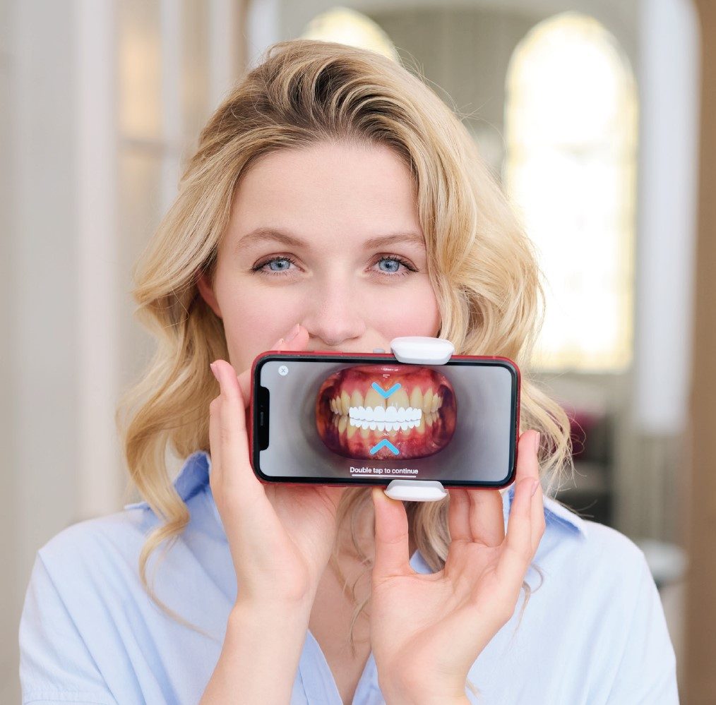 Zahnscan auf dem Smartphone