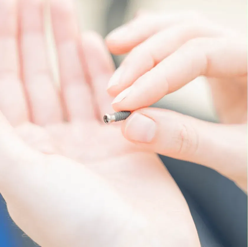 Zahnimplantat auf einer Handfläche